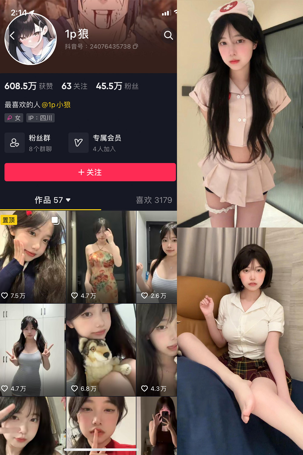 抖音 1p狼 微密圈  NO.006期 【12P3V】最新至