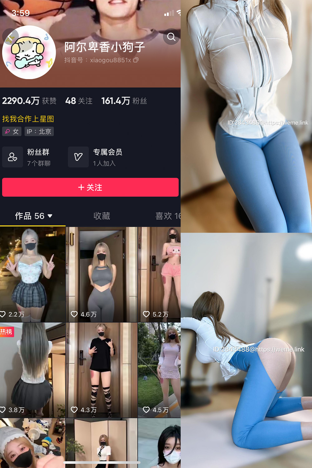 抖音 阿尔卑香小狗子 微密圈  NO.017期 【34P1V