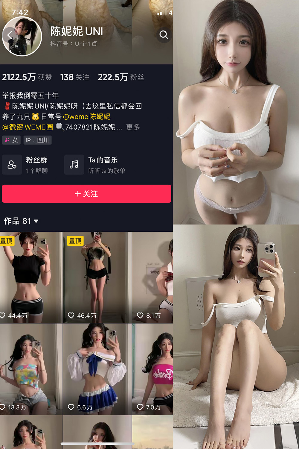 抖音 陈妮腻UNI 微密圈  NO.063期 【24P1V】