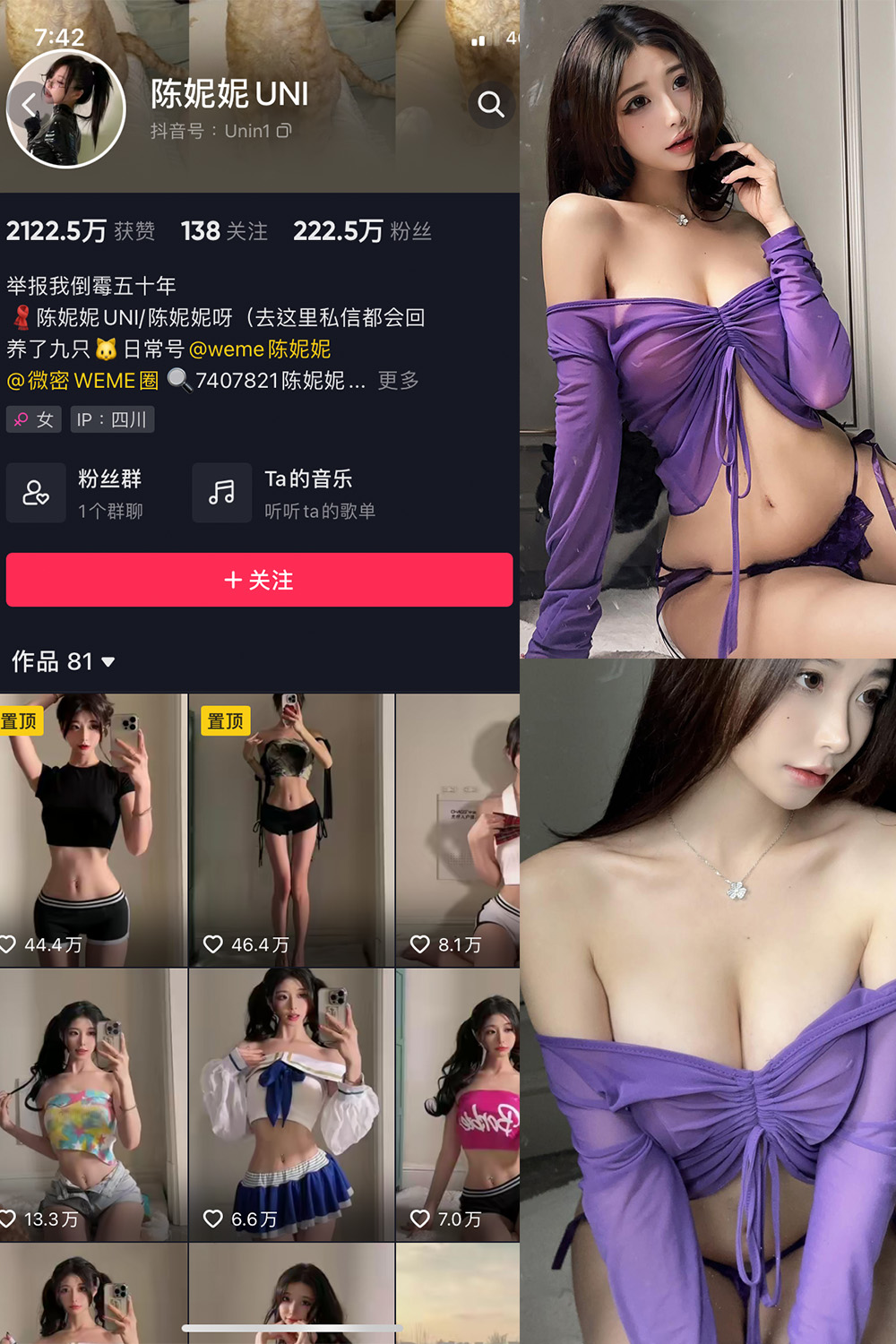 抖音 陈妮腻UNI 微密圈  NO.072期 【21P1V】