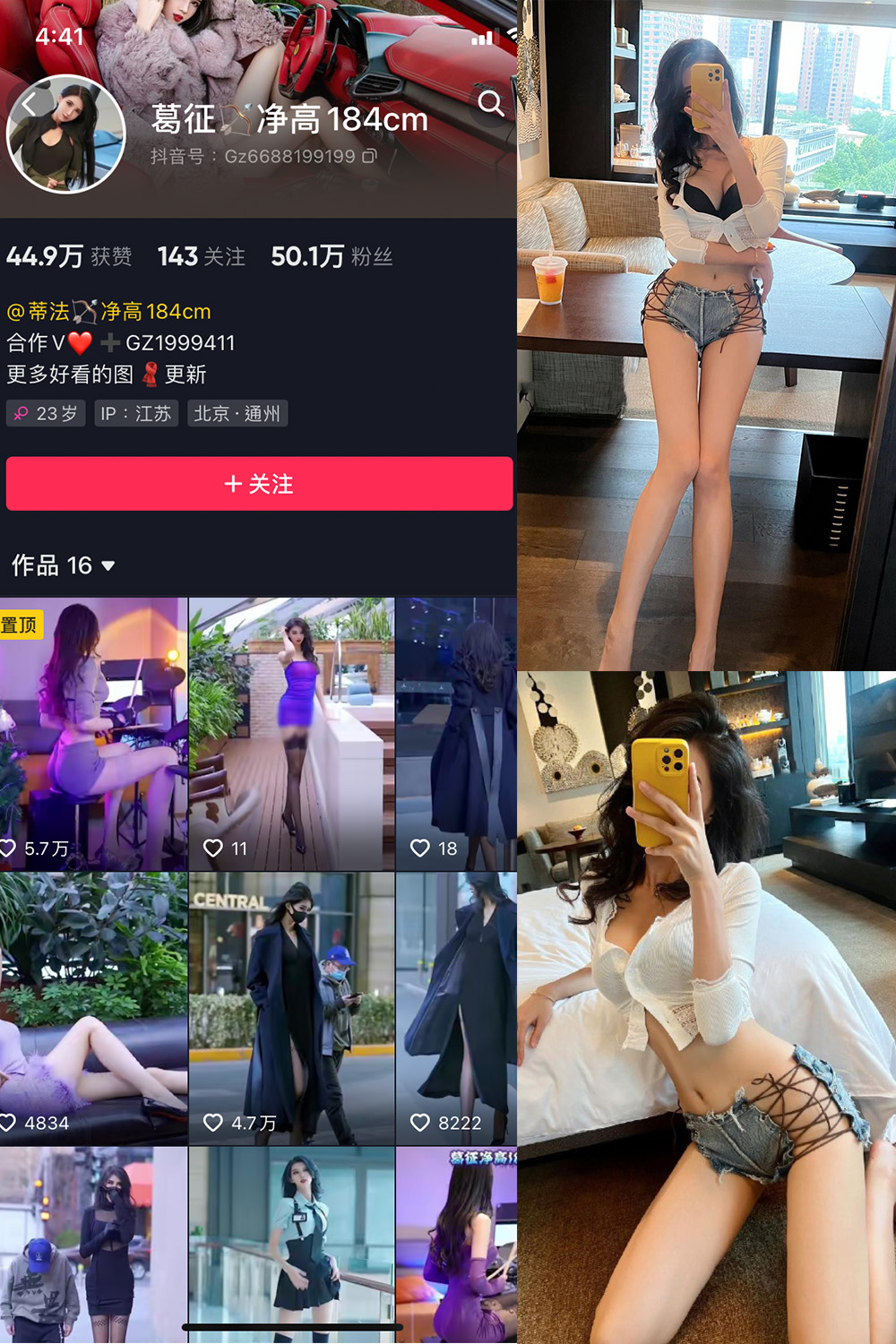 抖音 葛征 微密圈  NO.034期 【25P】