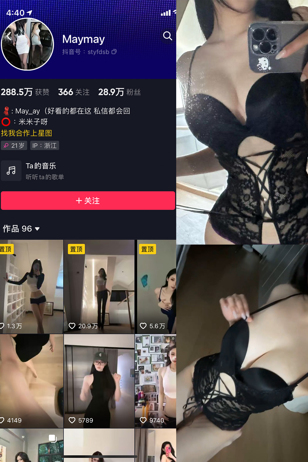 抖音 米米子呀 微密圈 NO.005期 【1P2V】最新至：