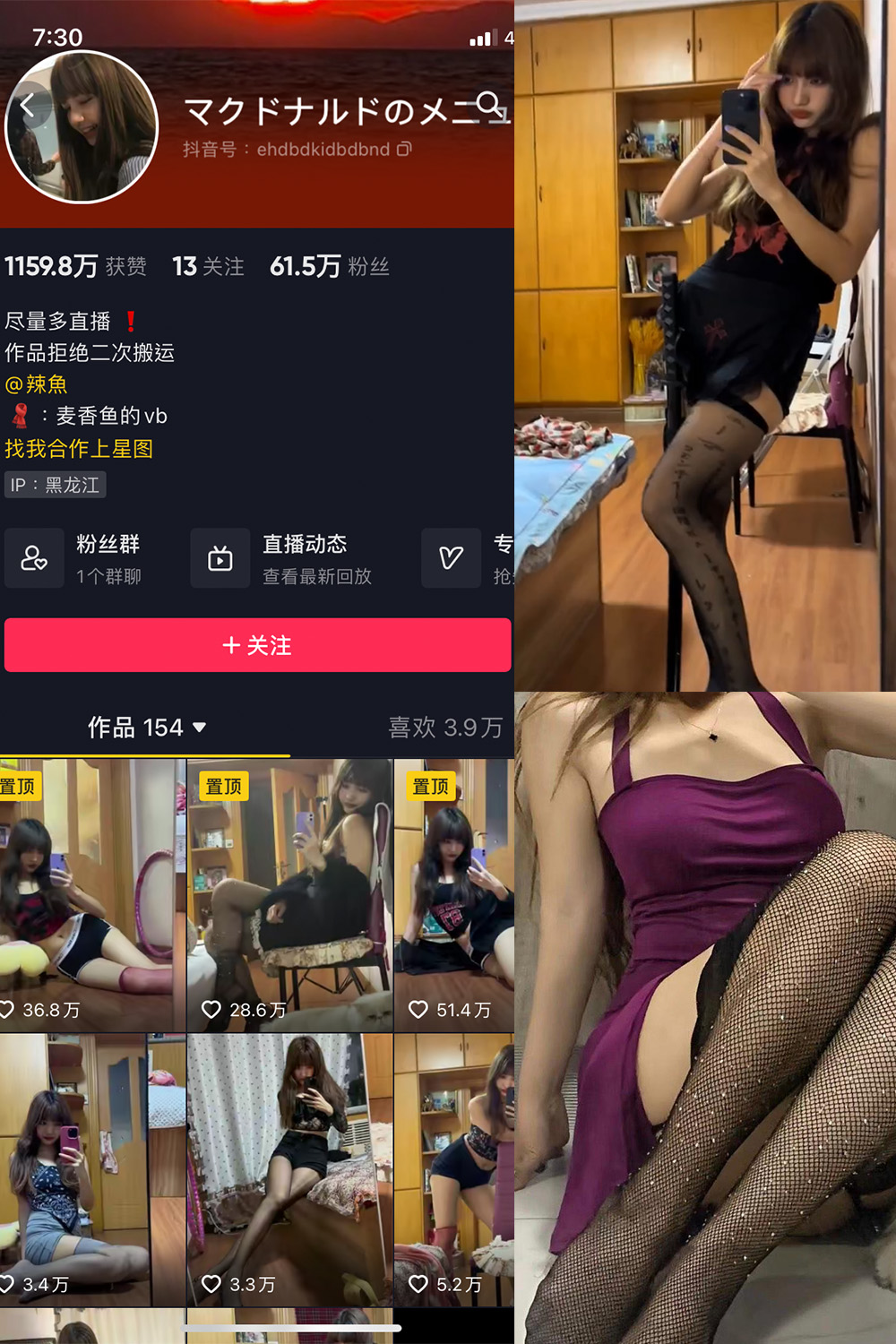 抖音 麦香鱼 微密圈 NO.004期 【5P2V】最新至：2