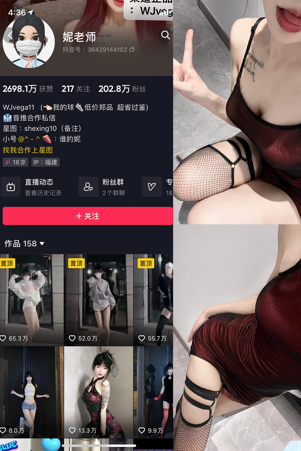 抖音 妮老师 微密圈  NO.001期 【21P10V】最新