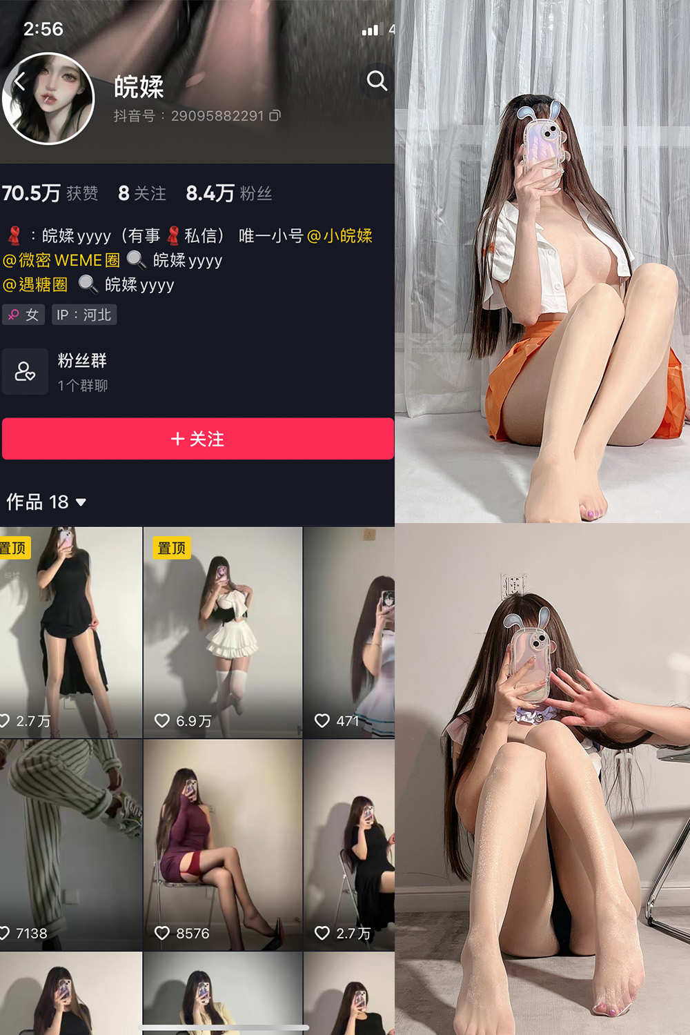 抖音 皖媃yyyy VIP 微密圈  NO.002期 【20