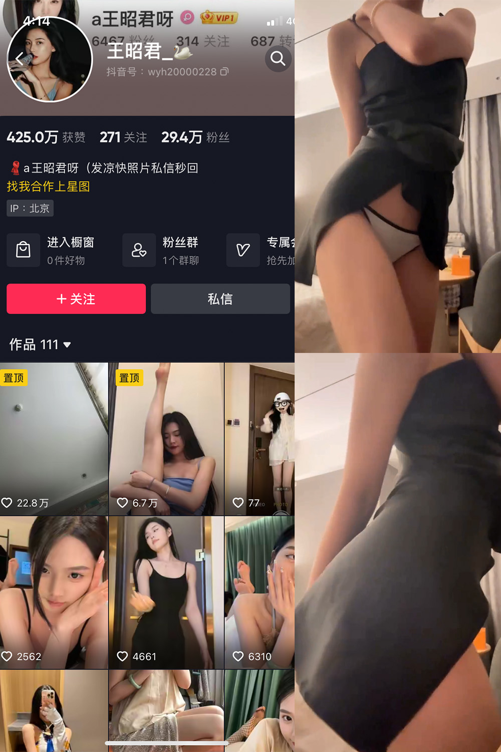 抖音 王昭君 微密圈  NO.010期 【11P1V】最新至