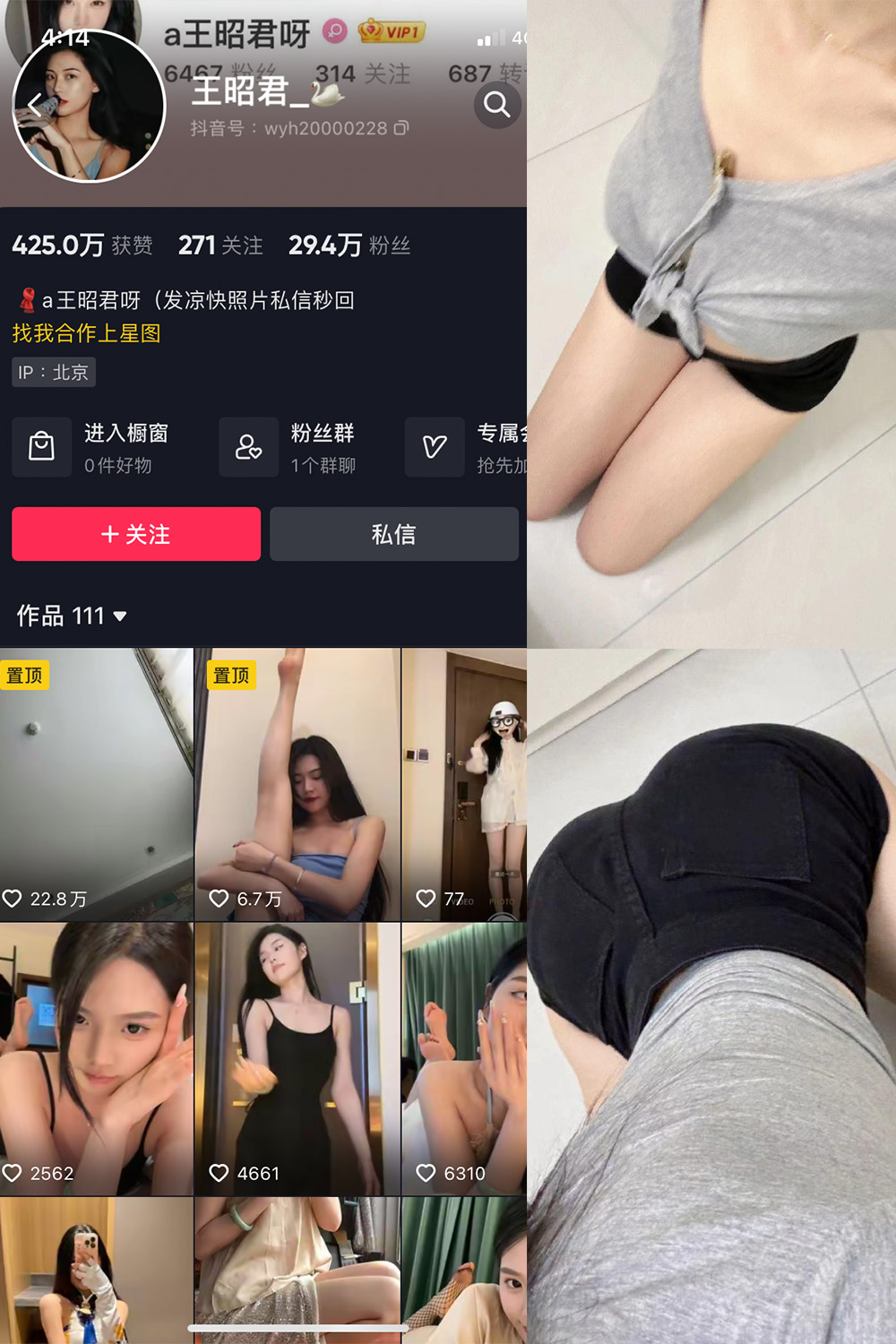 抖音 王昭君 微密圈  NO.017期 【23P】最新至：2