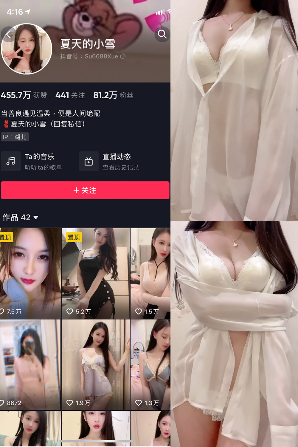 抖音 夏天的小雪 微密圈 嘉宾专享 NO.011期 【4P2